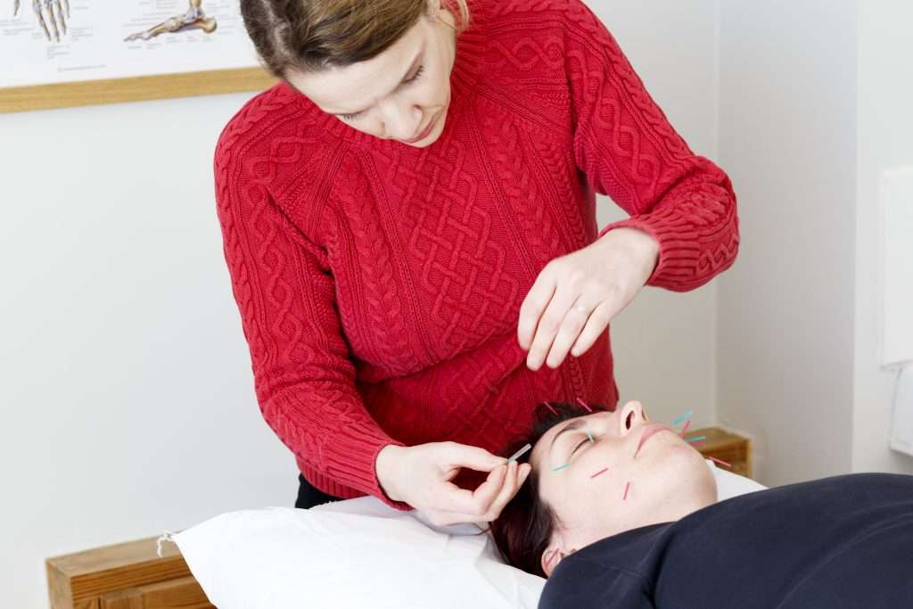 Fran doing facial acupuncture
