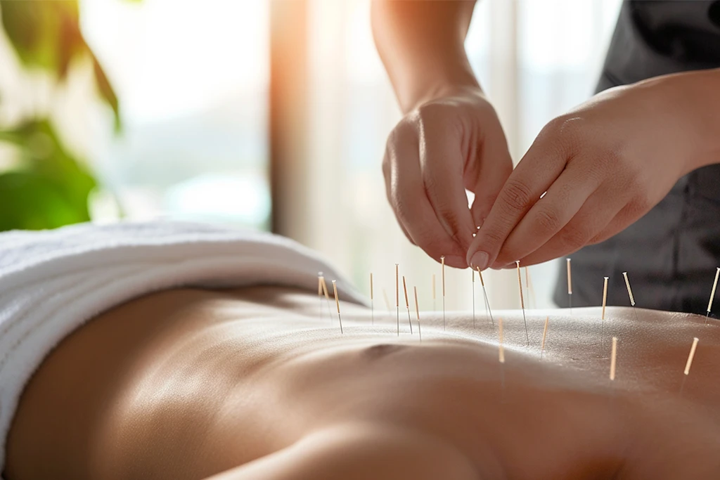 Heathfield Acupuncture